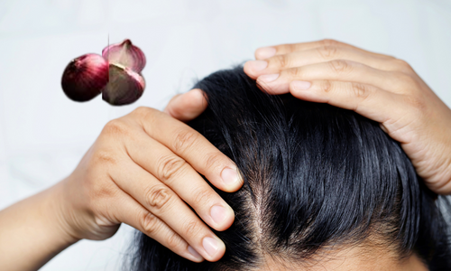 Benefits of Onion for Hair